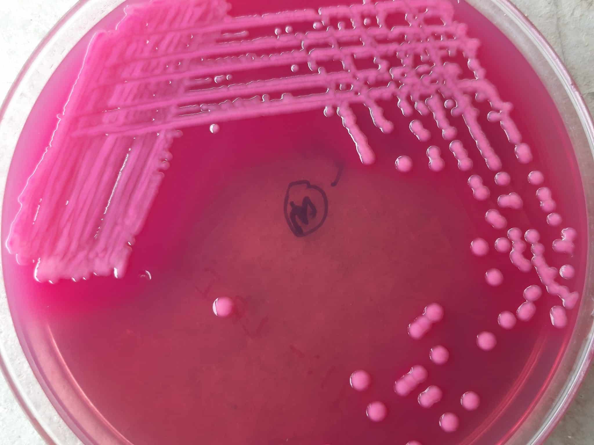 Klebsiella Pneumoniae UTI Treatment KNOW TREAT UTI   Klebsiella Pneumoniae Mucoid Lactose Fermenter MLF Colonies On MacConkey Agar 1 2048x1536 